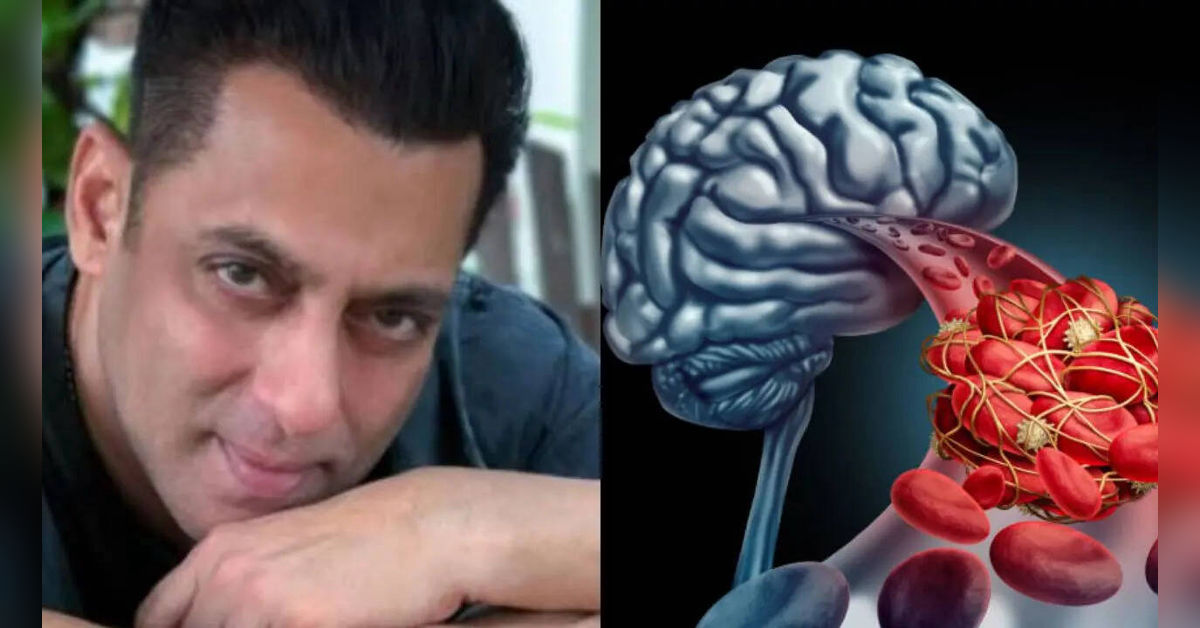 Salman Khan Reveals He's Suffering from a Brain Aneurysm - jeongbohub.com